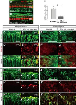 Regenerative Effect of a ROCK Inhibitor, Y-27632, on Excitotoxic Trauma in an Organotypic Culture of the Cochlea
